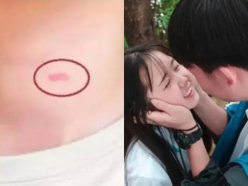 Con gái dậy thì có vết lạ trên cổ, mẹ ứng xử thông minh mọi phụ huynh nên học hỏi