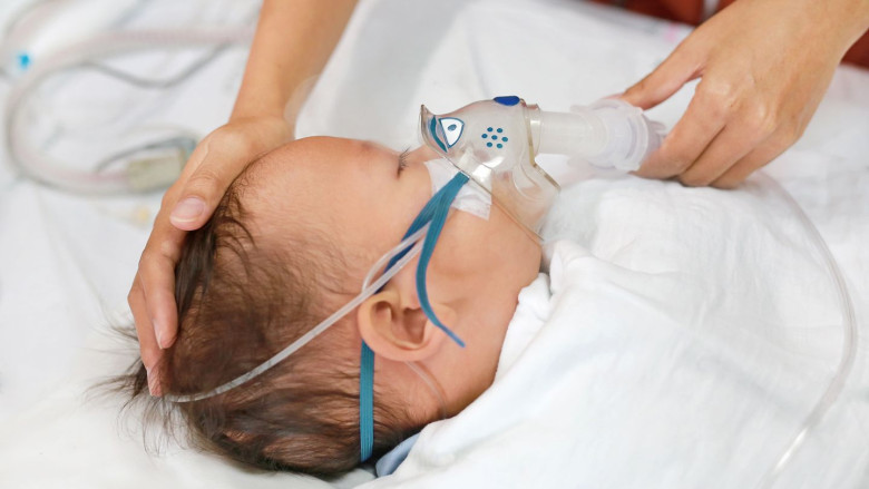 Dù không phải trường hợp nào trẻ nhiễm RSV cũng phải nhập viện, nhưng phụ huynh tuyệt đối không chủ quan. Ảnh minh họa. 