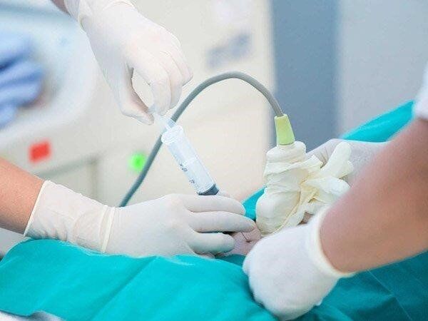 Chọc ối thai nhi làm xét nghiệm ADN không được các chuyên gia khuyến kích vì có thể gặp rủi ro cho mẹ và bé. Ảnh minh họa. 