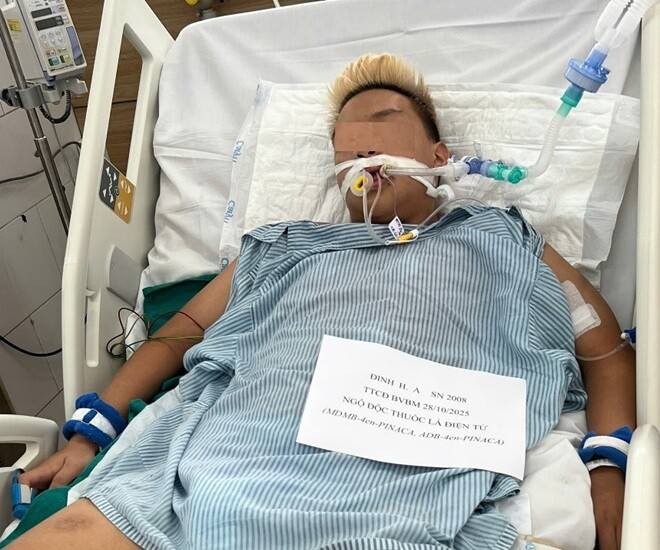 Nam thiếu niên suy thận, hỏng phổi vì hút thuốc lá điện tử từ năm 13 tuổi. Ảnh: BSCC.