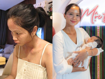 Chi nửa tỷ/tháng để ở cữ, HHen Niê nay biến dạng ngoại hình vì bệnh lạ sau sinh, chỉ 1/10 người gặp phải