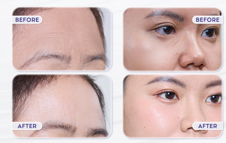 Thẩm mỹ Linh Anh Premium ra mắt Revoke50® - Giải pháp Skinbooster thế hệ mới giúp tái tạo và trẻ hóa da toàn diện - 4