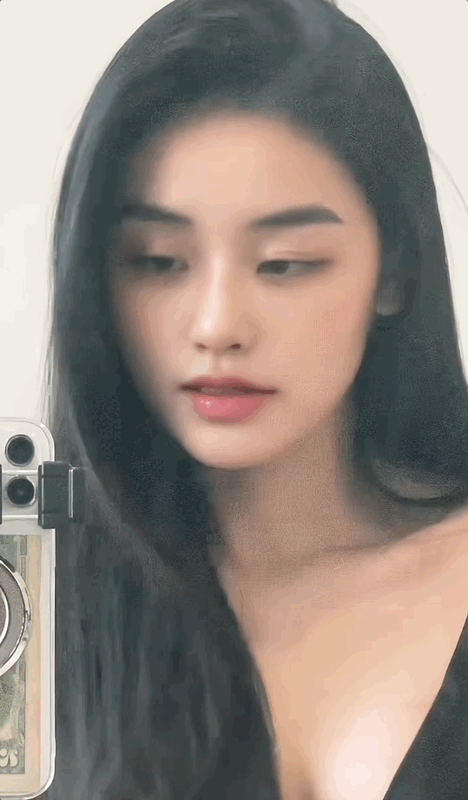 Hình ảnh lạ lẫm của Hoa hậu Yến Nhi sau khi dao kéo phần mũi.