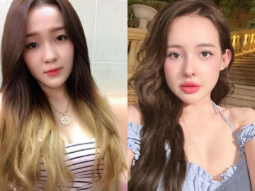 10 năm qua, Ngân 98 từng "nghiện" phẫu thuật thẩm mỹ ra sao?