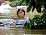 Sức khỏe - Nhiều người bị ảnh hưởng, sống trong vùng bão lũ, bác sĩ cảnh báo các căn bệnh dễ lây và bùng phát