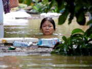 Sức khỏe - Nhiều người suy đa tạng nguy kịch, phải lọc máu vì một tác nhân gây bệnh mùa mưa lũ rất dễ nhầm lẫn