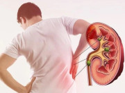 Sức khỏe - Dấu hiệu nào cảnh báo thận đang “kêu cứu”? Có tín hiệu dễ thấy vào buổi sáng nhưng nhiều người lười quan sát