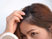 Sức khỏe - Trẻ tuổi tóc đã bạc có phải dấu hiệu mắc bệnh nan y, thực hư việc tóc bạc chuyển đen chỉ sau 2 ngày điều trị?
