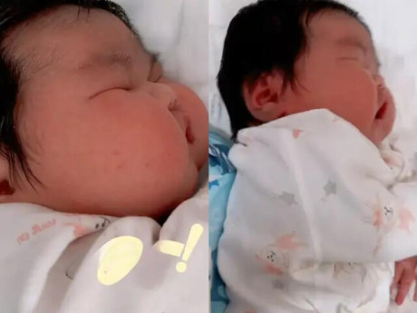 Bé sơ sinh chào đời như “người khổng lồ”, nặng 11kg, hai má phúng phính bánh bao khiến cả bệnh viện xôn xao