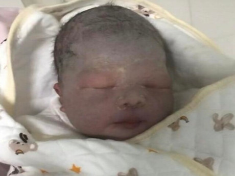 Yêu con - Bé sơ sinh chào đời da tím tái như quả cà, bố sợ không dám đến gần, 3 tháng sau diện mạo gây ngỡ ngàng