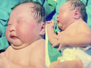 Yêu con - Bé sơ sinh chào đời nặng 9kg, cổ mất hút, bác sĩ đỡ đẻ lắc đầu: “Đứa bé này như trẻ 1 tuổi”