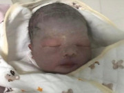 Yêu con - Bé sơ sinh chào đời da tím tái như quả cà, bố sợ không dám đến gần, 3 tháng sau diện mạo gây ngỡ ngàng