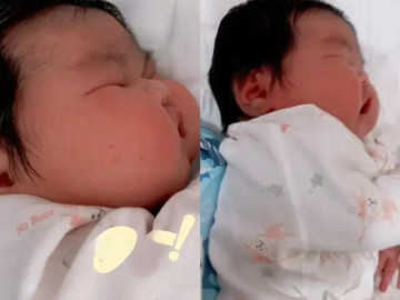 Bé sơ sinh chào đời như người khổng lồ, nặng 11kg, hai má phúng phính bánh bao khiến cả bệnh viện xôn xao