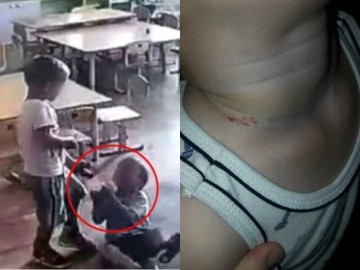 Đón con đi học về thì phát hiện trên cổ bé có vết bầm, kiểm tra camera mẹ Nga bủn rủn với cảnh tượng giữa lớp