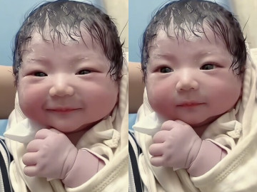 Bé sơ sinh chào đời đẹp như nữ thần, y tá đỡ đẻ vừa nhìn đã thốt lên: Bé đã phẫu thuật thẩm mỹ thành công