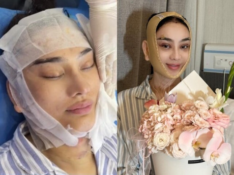 "Phú bà" 10 lần nằm bàn mổ để "đổi mặt": Giàu từ đời cha đến con, tiêu xài mười mấy tỷ mỗi năm