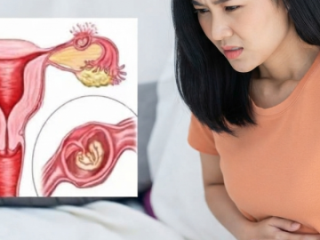 Bà bầu - Dấu hiệu mang thai ngoài tử cung cần nhận biết sớm