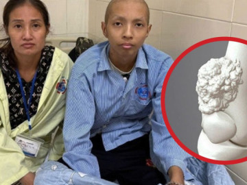 Cậu bé 16 tuổi mồ côi cha từ nhỏ phải cắt một phần chân vì ung thư