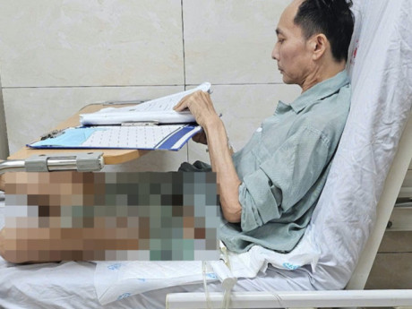 Gia đình chuẩn bị di ảnh lo hậu sự, người đàn ông bất ngờ hồi phục