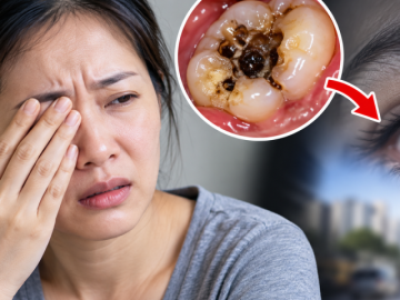Người phụ nữ 35 tuổi suýt mất thị lực vì ổ sâu răng lâu năm