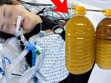 Hai vợ chồng lần lượt qua đời vì ung thư gan, 'sát thủ' giấu mặt trong bếp