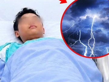 Bị sét đánh ngừng tim, thiếu niên 14 tuổi thoát cửa tử sau 30 phút cấp