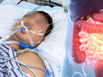 Rối loạn tiêu hóa suốt 2 tuần, người đàn ông bàng hoàng phát hiện ung thư