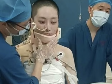 Rơi từ tầng 35, nữ streamer 28 tuổi sống sót kỳ diệu sau 16 lần phẫu thuật