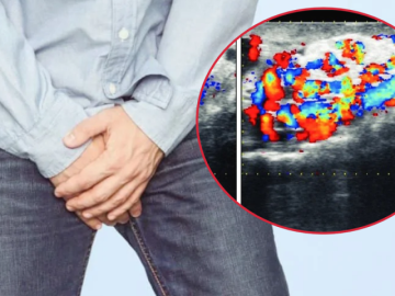 Nam giới 30 tuổi hiếm muộn, phát hiện nguyên nhân từ một bệnh lý ít triệu chứng