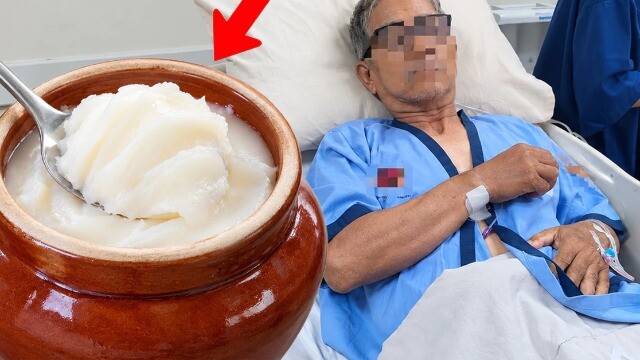 Người đàn ông ăn mỡ lợn suốt nhiều năm, kết quả khám nhiều người bất ngờ