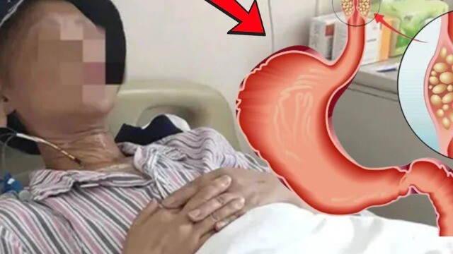 Duy trì 1 thói quen, người đàn ông 53 tuổi phát hiện ung thư từ rất sớm