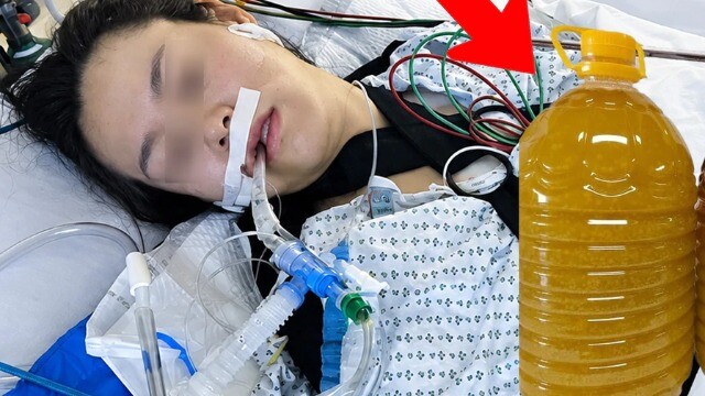 Hai vợ chồng lần lượt qua đời vì ung thư gan, 'sát thủ' giấu mặt trong bếp