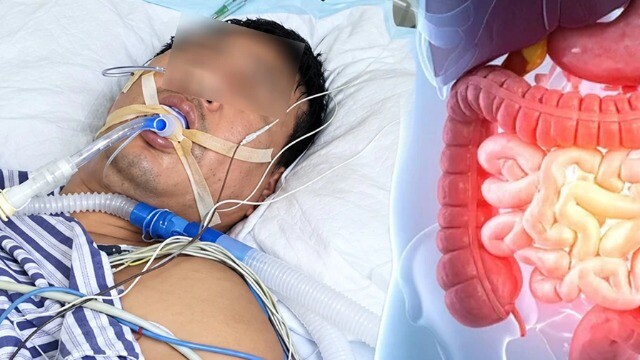 Rối loạn tiêu hóa suốt 2 tuần, người đàn ông bàng hoàng phát hiện ung thư