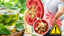 Uống nước lá chữa sỏi thận, người bệnh cần biết điều này trước khi quá muộn