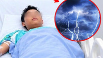 Bị sét đánh ngừng tim, thiếu niên 14 tuổi thoát cửa tử sau 30 phút cấp