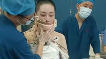 Rơi từ tầng 35, nữ streamer 28 tuổi sống sót kỳ diệu sau 16 lần phẫu thuật