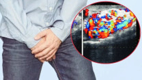 Nam giới 30 tuổi hiếm muộn, phát hiện nguyên nhân từ một bệnh lý ít triệu chứng
