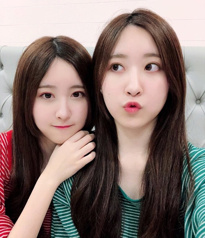 Hai con gái được người lạ tặng tiền tỷ vì xinh như thiên thần, cuộc sống hiện tại không ngờ nhờ quyết định của bố mẹ - 3