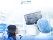 Đẹp mà an toàn: Những điều cần biết khi lựa chọn làm răng sứ thẩm mỹ