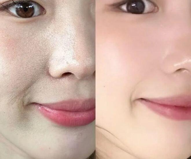 Lớp nền bóng dầu, xê dịch khiến phái đẹp mất tự tin (trái).